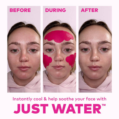 Facial Cooling Clouds® Reusable Patches  3pc